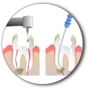 Endodonție